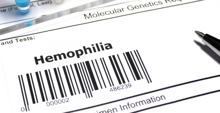 haemophilia